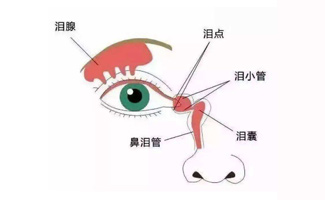 泪道阻塞或狭窄